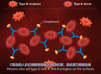 II型超敏反应哔哩哔哩bilibili