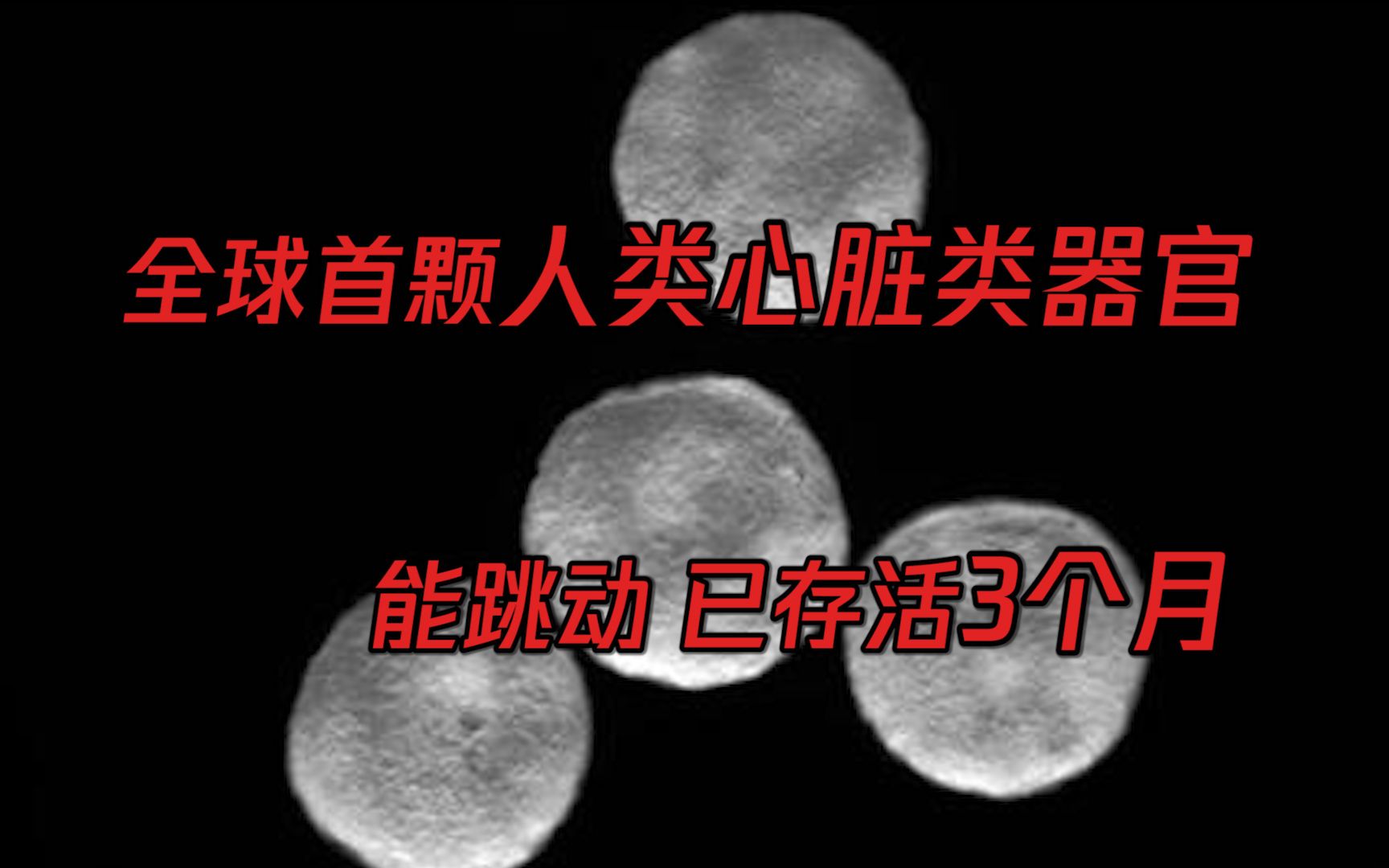 首颗实验培育人类心脏类器官,能跳动,已存活3个月哔哩哔哩bilibili