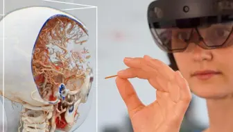ARVR/MR应用⑭医疗保健：1.2 西门子医疗影像设备IT可视化、数字医疗全息投影