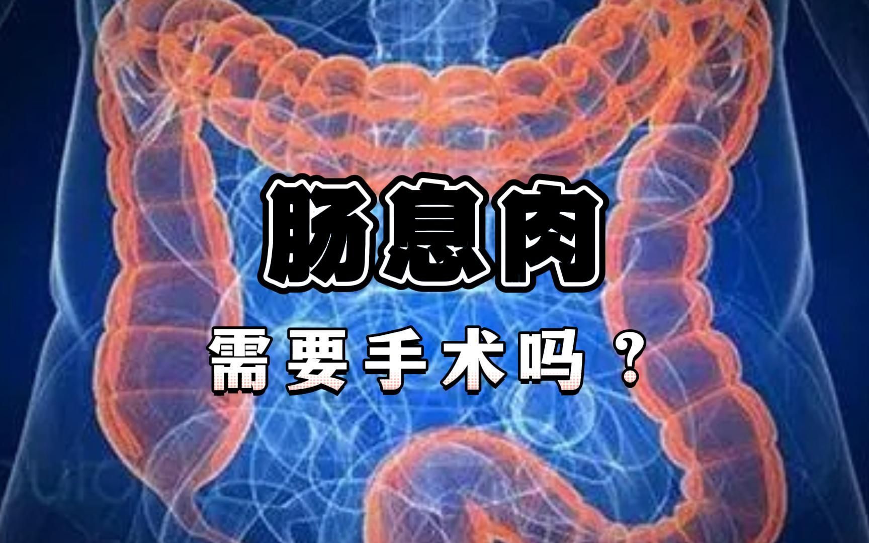 腸息肉需要手術嗎生活中注意些什麼呢