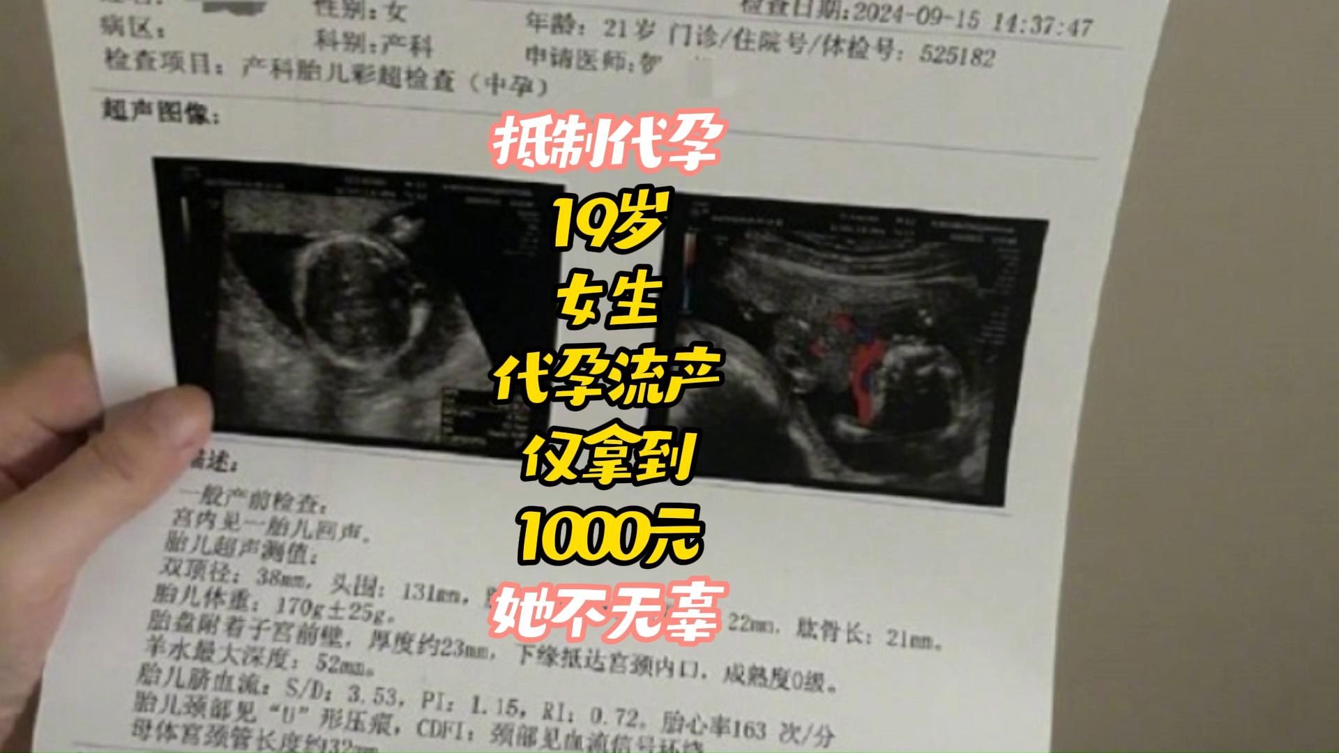 19岁女生代孕流产仅拿到1000元,首次卖卵获得2.5万,她不值得可怜哔哩哔哩bilibili