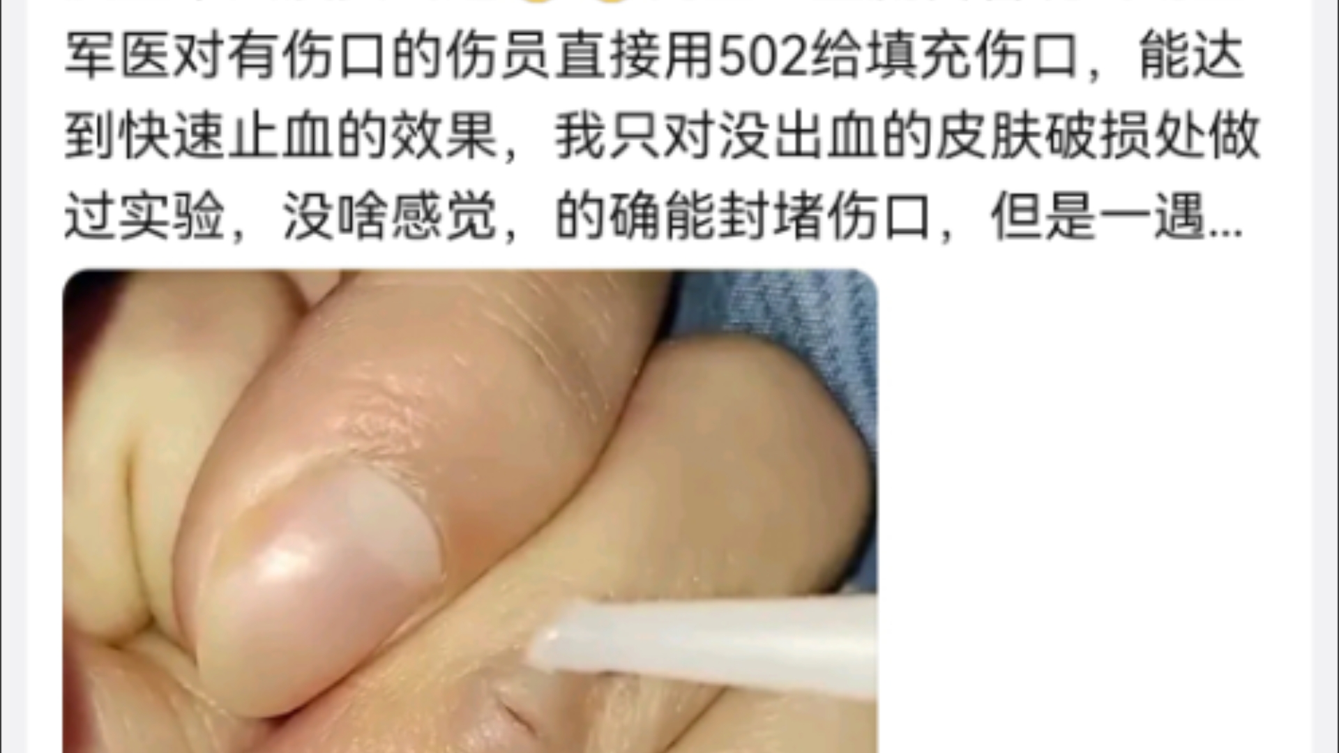 502胶水能用来止血吗?手机游戏热门视频