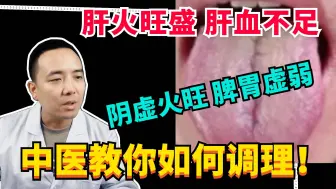 Download Video: 肝火旺盛 肝血不足，阴虚火旺 脾胃虚弱，中医教你如何调理！