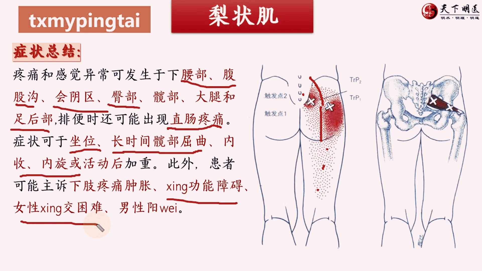 梨状肌的位置、梨状肌的功能、梨状肌的激痛点、梨状肌损伤后的症状、梨状肌的处理方法4个方面全方位讲解——天下明医平台简灵奇针尹振汉讲解哔哩哔...