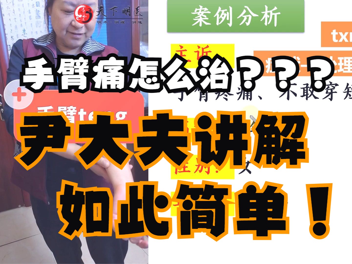 疼痛,不敢穿短袖)——使用天下明医平台简灵奇针第3套新肌筋膜松解术