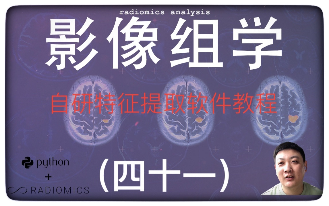 〖免费〗影像组学特征提取软件使用介绍|影像组学放飞自我篇(片尾附资料群二维码及个人微信)哔哩哔哩bilibili