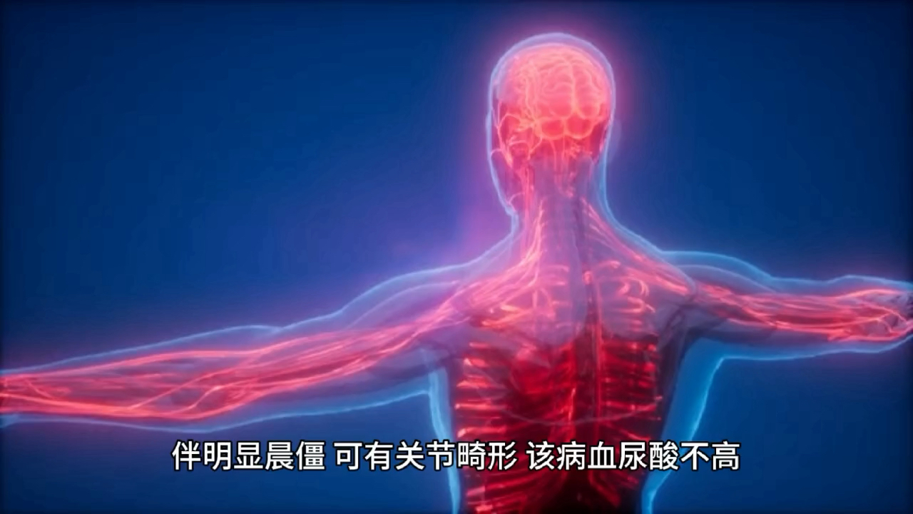 包含擅長(zhǎng)：強(qiáng)直性脊柱炎、類風(fēng)濕關(guān)節(jié)炎、痛風(fēng)性關(guān)節(jié)炎、骨性關(guān)節(jié)炎等常見(jiàn)關(guān)節(jié)炎病，和紅斑狼瘡、...跑腿掛號(hào)，外地就醫(yī)方便快捷的詞條
