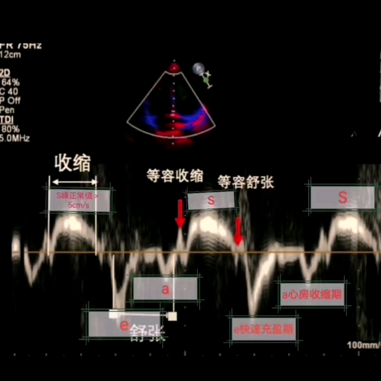 超声组织多普勒技术解读哔哩哔哩bilibili