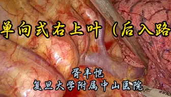 单向式右肺上叶切除术（后入路）解说版 胥丰恺教授供稿