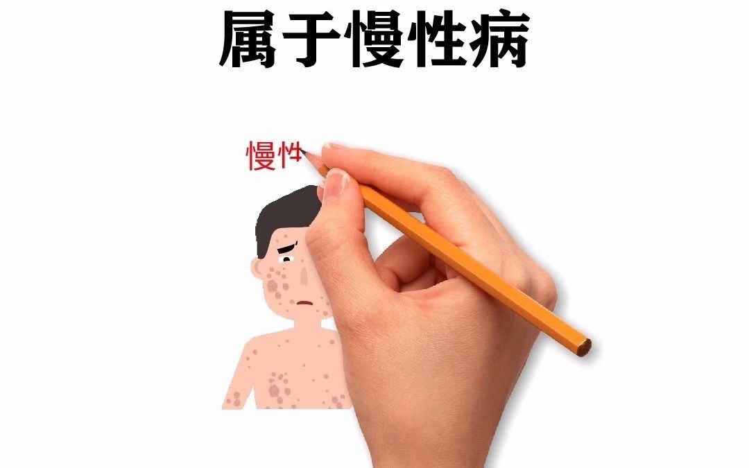 卡泊三醇软膏哪个牌子好?知名品牌盘点哔哩哔哩bilibili