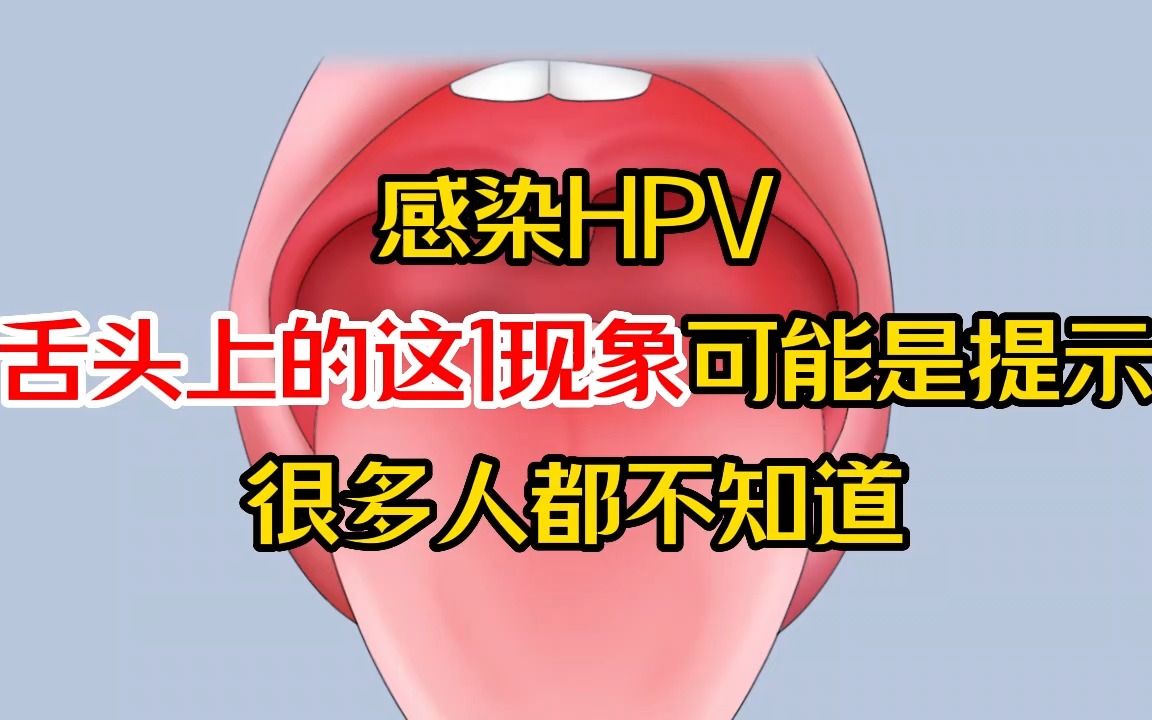 感染hpv,舌頭上的這1現象可能是提示,很多人都不知道