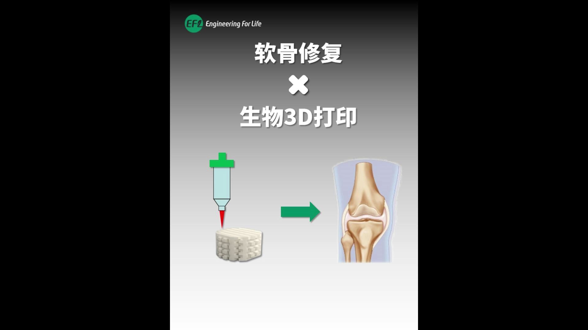 生物3D打印技术与应用软骨修复哔哩哔哩bilibili