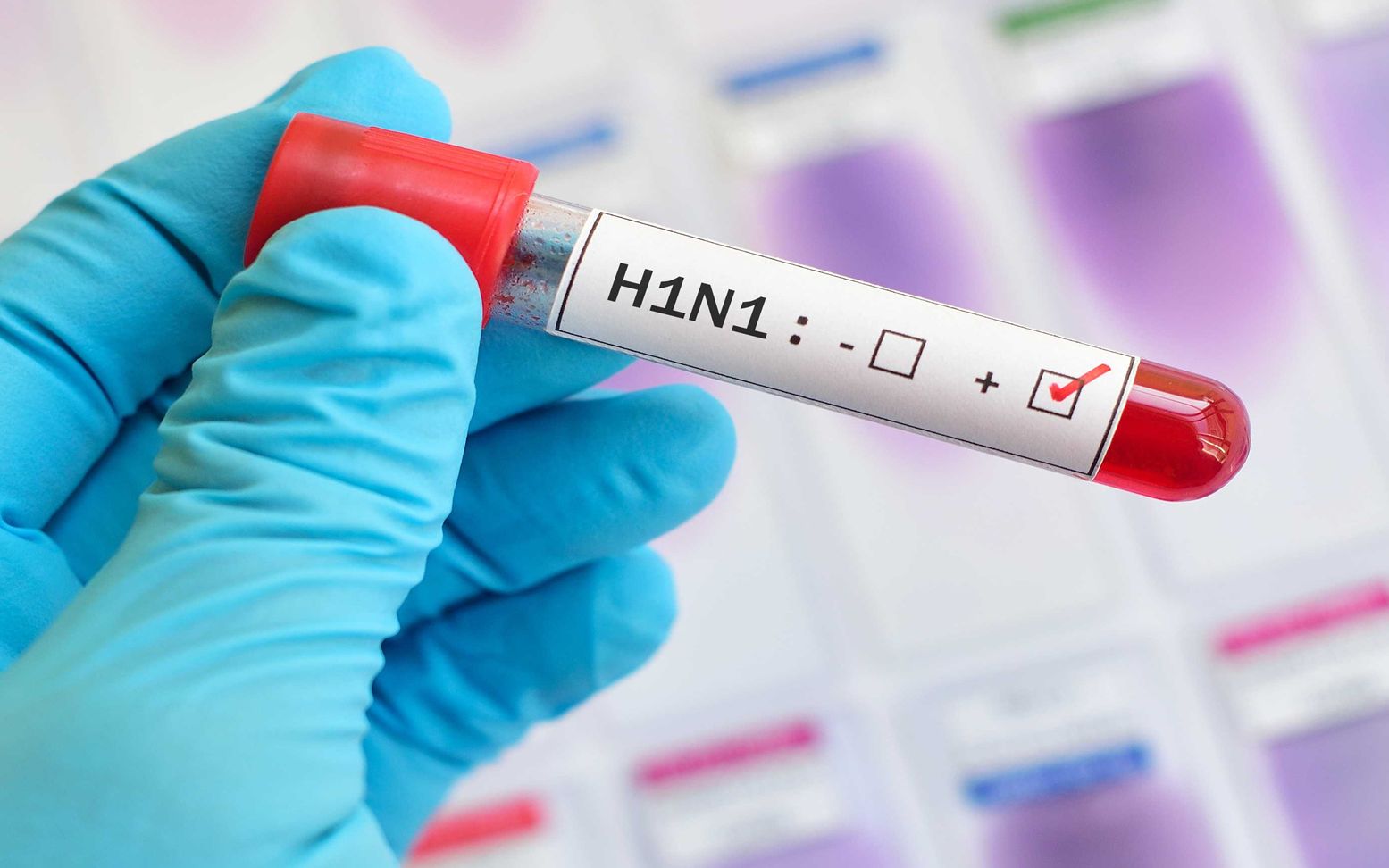 感染中国12万人的甲型H1N1,你还记得么?哔哩哔哩bilibili