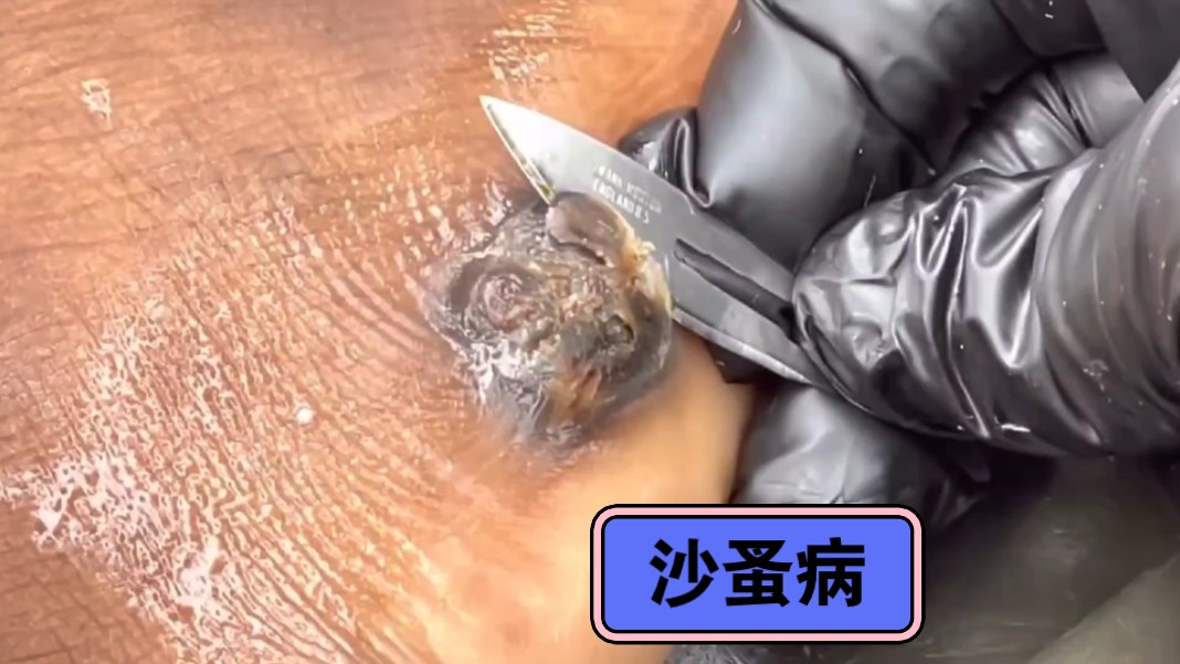 奥德彪的沙蚤脚