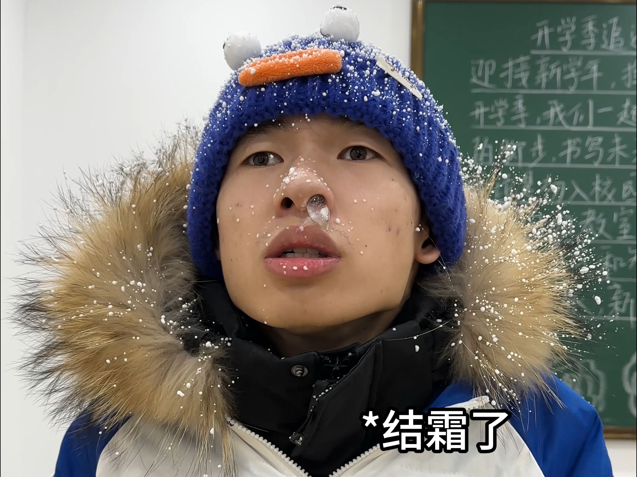耶？要不要打一针？