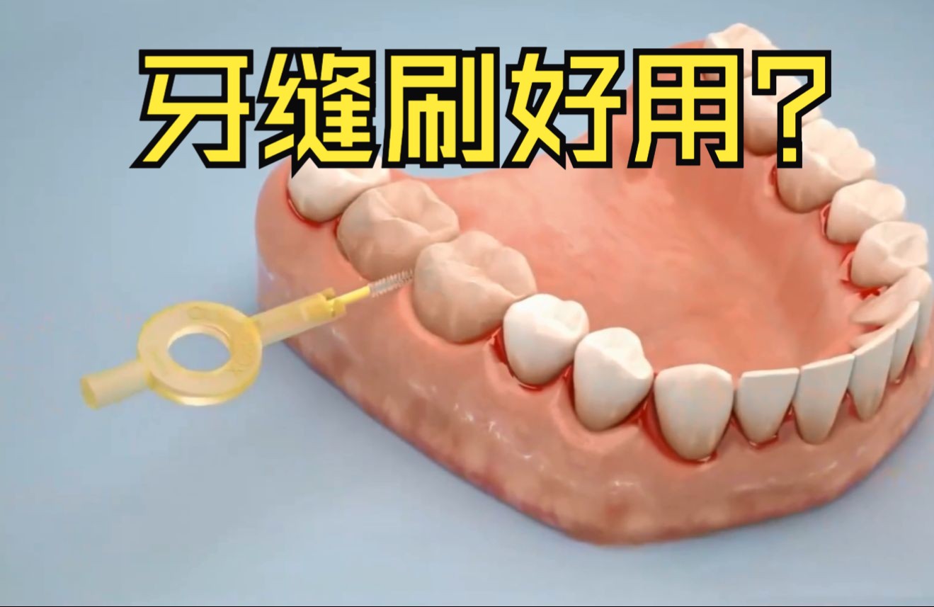 牙缝刷真的能解决问题吗?口腔医生看过来,牙缝刷效果如何哔哩哔哩bilibili