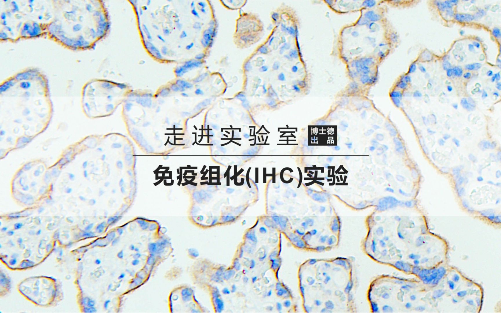 免疫组化实验 (IHC)哔哩哔哩bilibili