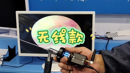 可视采耳采耳神器可视耳镜采耳仪器机器采耳采耳可视耳镜厂家采耳设备