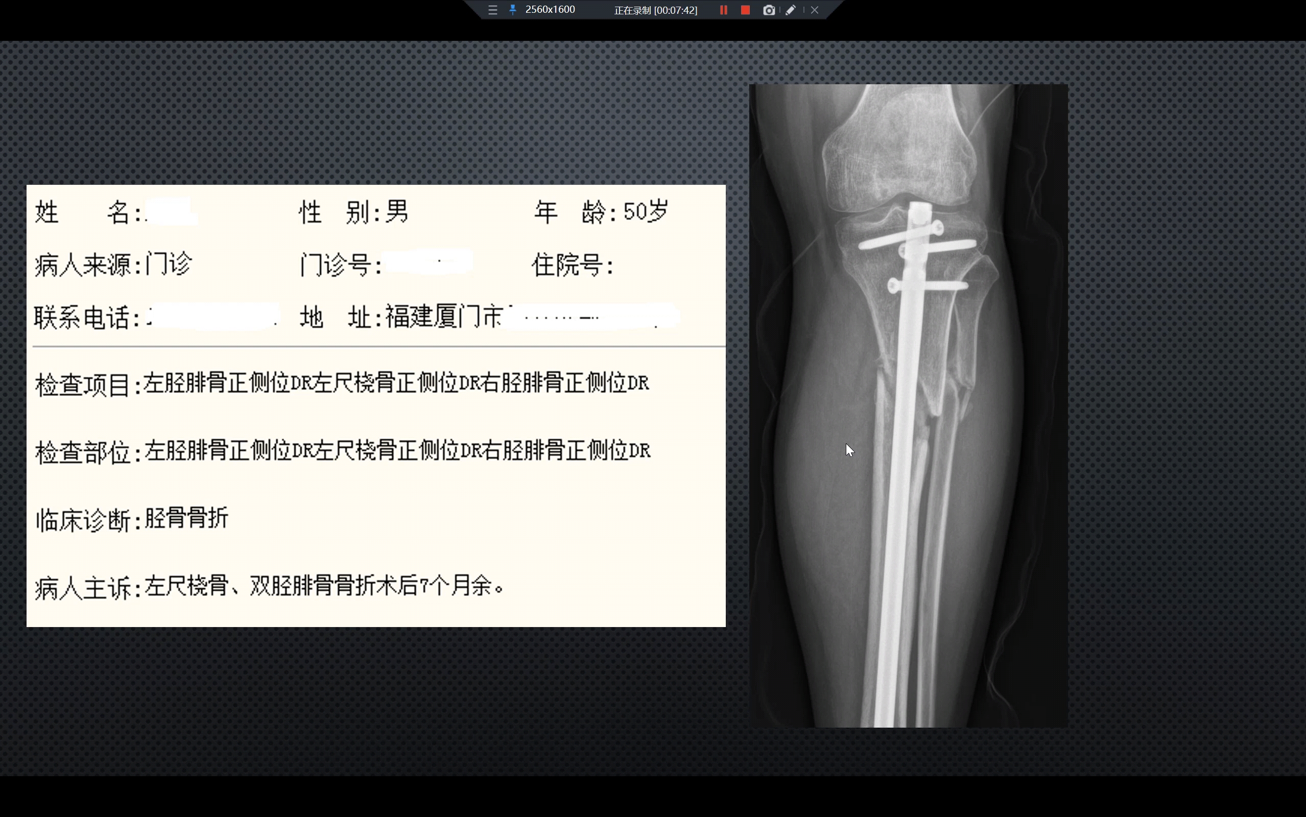 影像工作中临床申请单存在的问题(多数申请单都很好,我举出来的都是极个别案例,大家请勿对号入座,谢谢!)哔哩哔哩bilibili