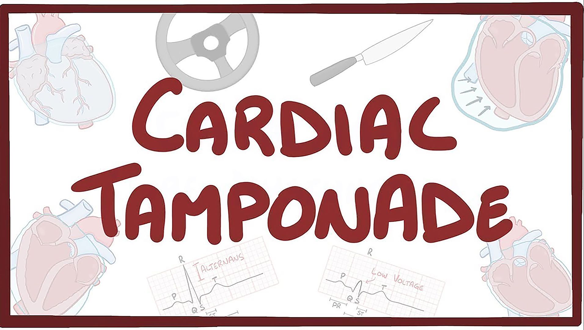 【Osmosis】 心包填塞 Cardiac Tamponade(中英字幕)哔哩哔哩bilibili