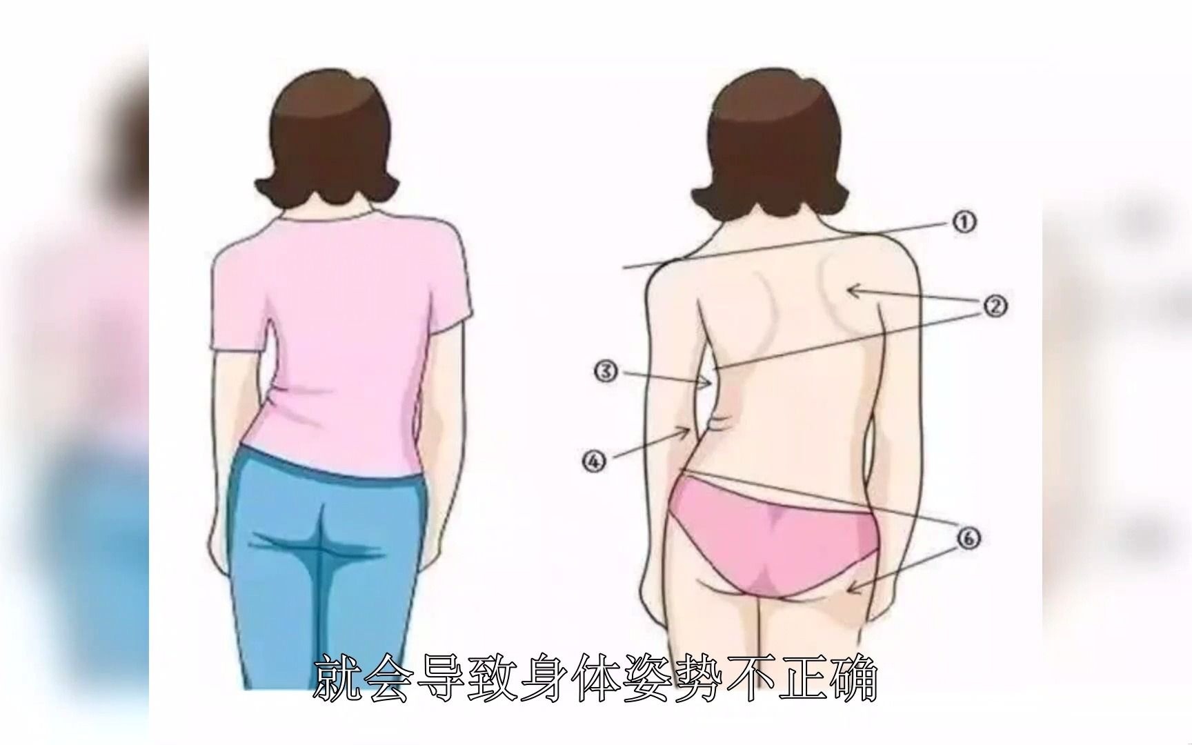 跑步对矫正体态有帮助吗