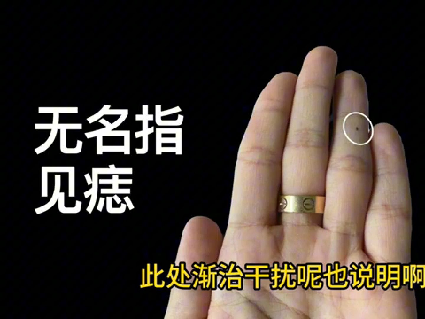 冲天纹,注定是亿万富豪命!