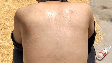 健康永远是第一的,都说三伏天晒背有好处,不知道晒的对不对?