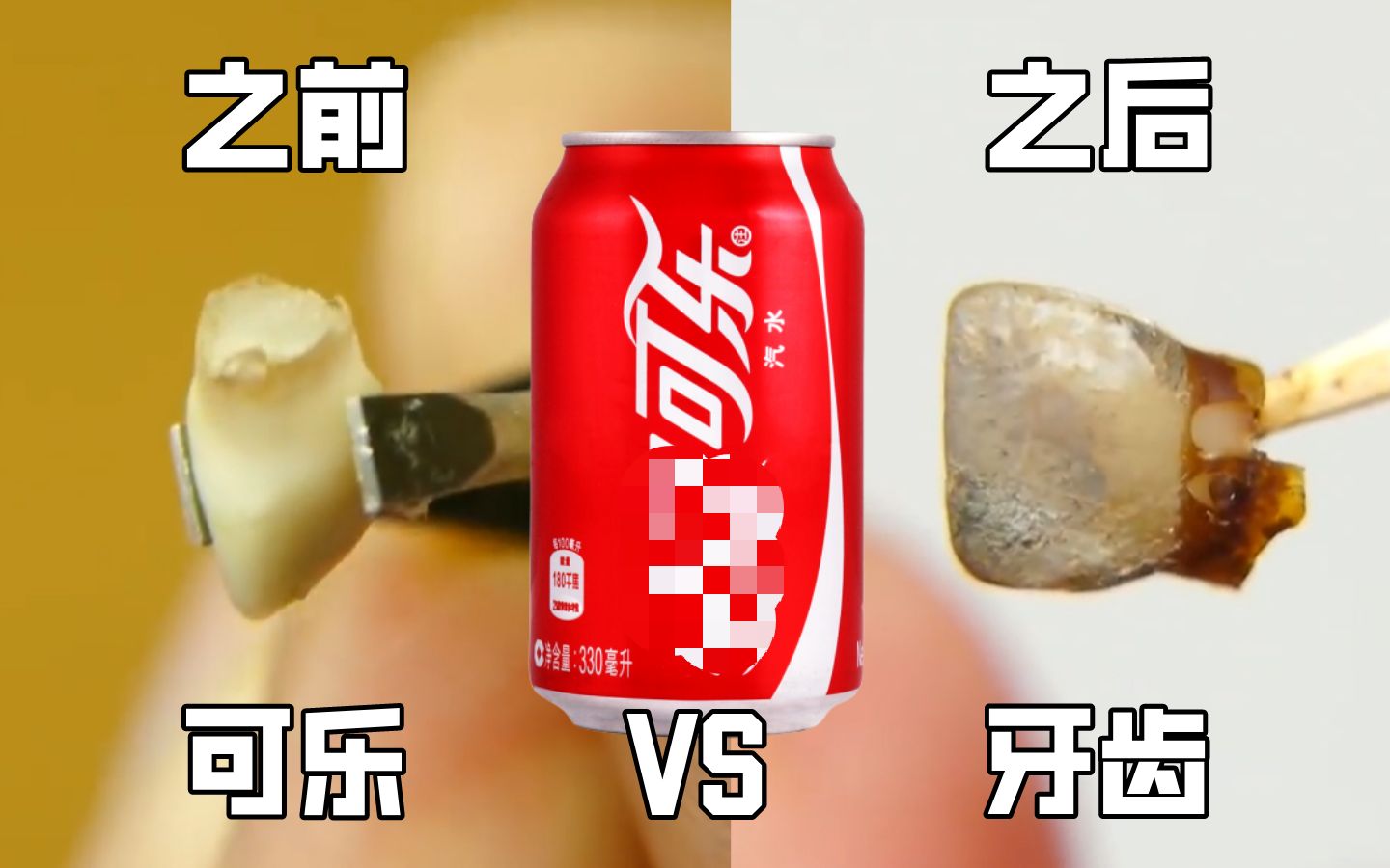 [图]“可乐”VS“牙齿”一周后会发生什么神奇的变化呢？