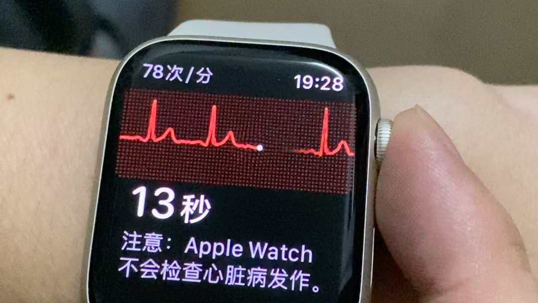 苹果手表的心电图功能