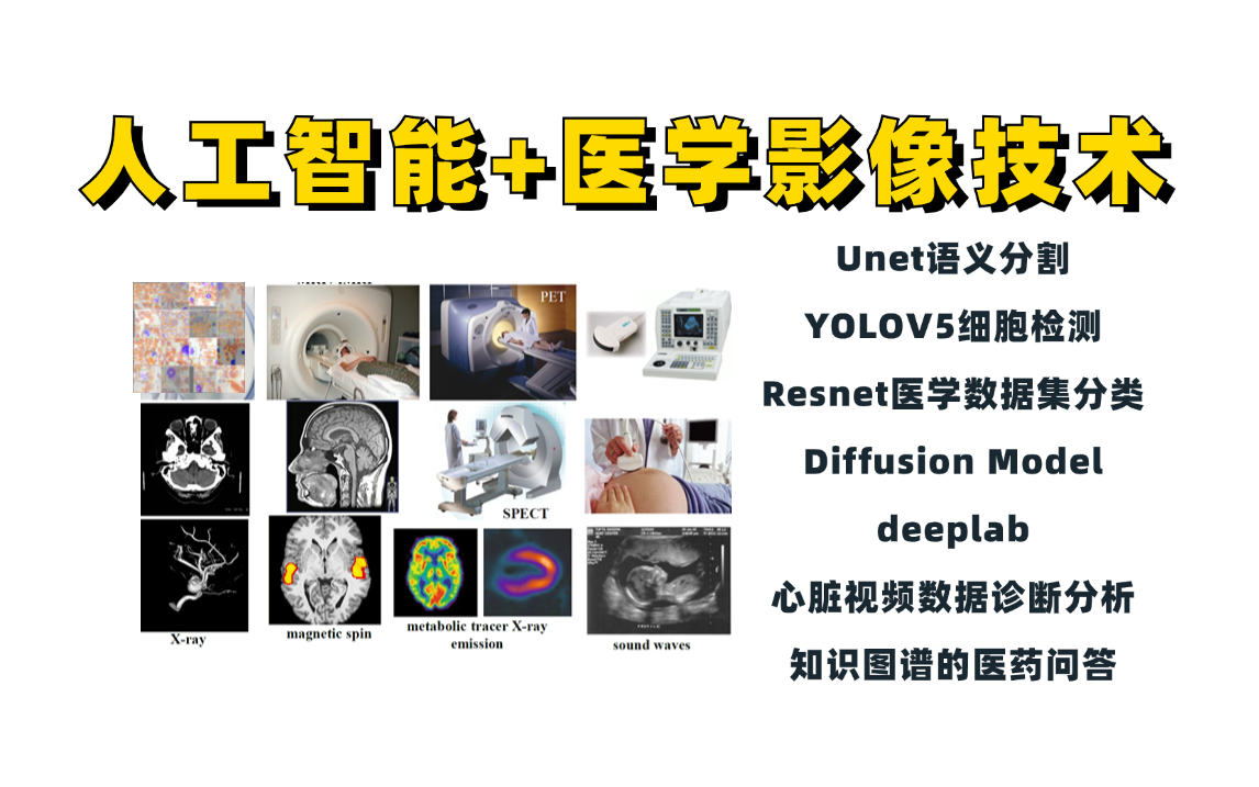 AI医学影像如何确定自己的研究方向?看论文、做调研、找空白!Unet图像分割、YOLOV5细胞检测、deeplab、知识图谱、Diffusion模型哔哩哔哩bilibili