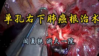 单孔胸腔镜右肺下叶癌根治术 1.5倍速未剪辑 闾夏轶教授供稿