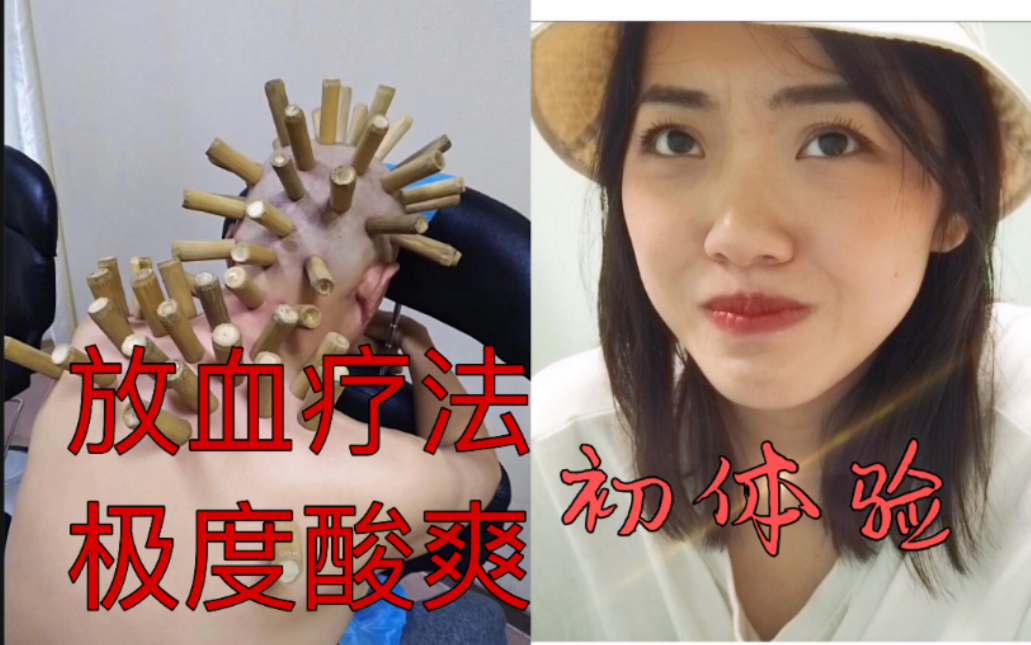 up第一次拔罐放血被吓晕!极度酸爽的放血疗法初体验!