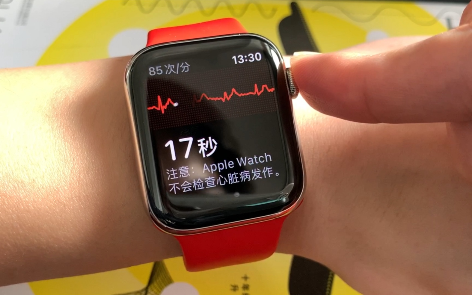 apple watch 国行 ecg心电图_哔哩哔哩_bilibili