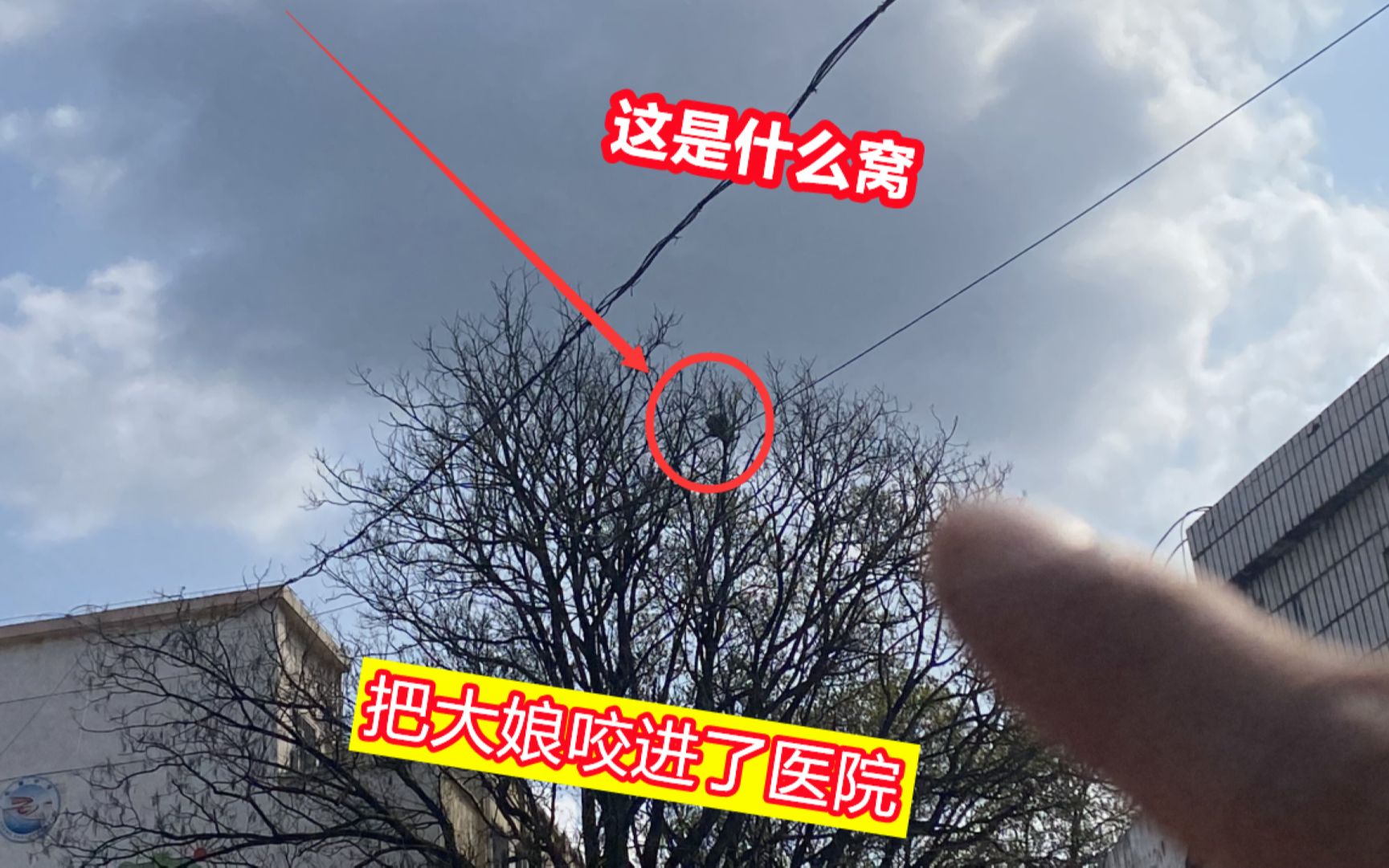 [图]大娘路过学校被咬进医院，发现树上一个大窝，没办法还是报警吧