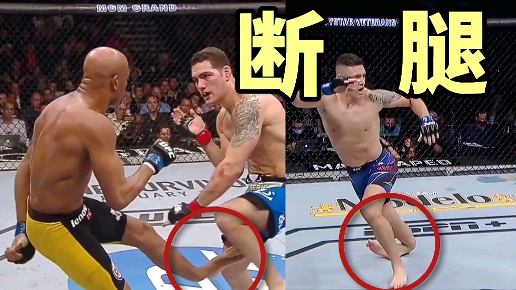 格斗界严重断腿事故,蜘蛛人,魏德曼,嘴炮断腿惨烈瞬间_哔哩哔哩