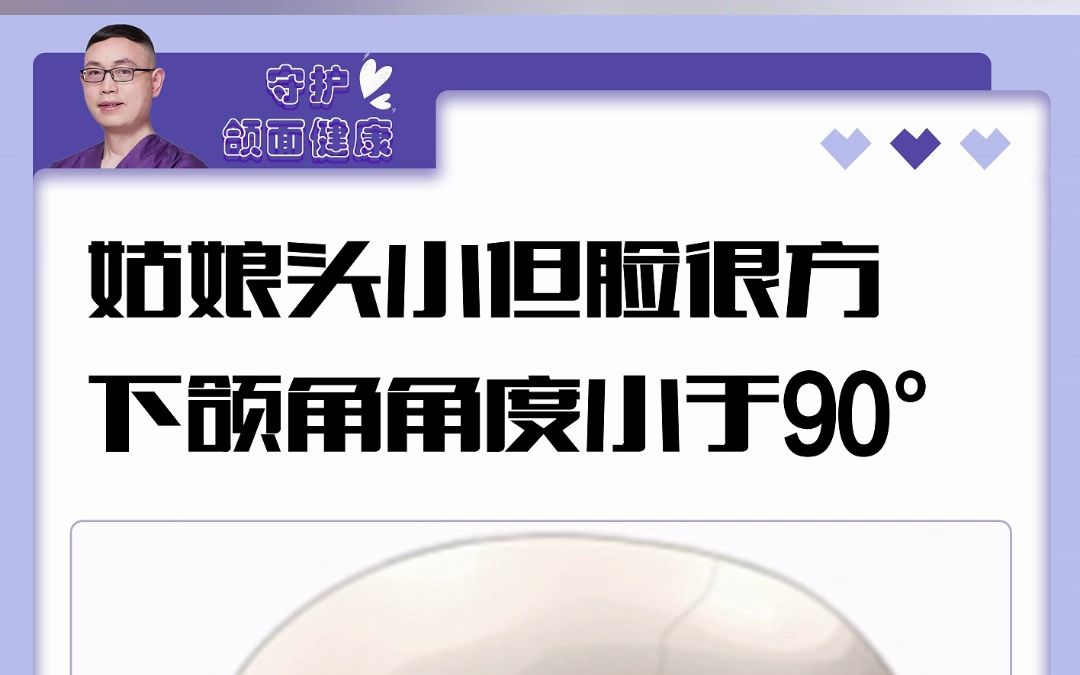 【重庆肖林】姑娘头小但脸很方,下颌角角度小于90度哔哩哔哩bilibili