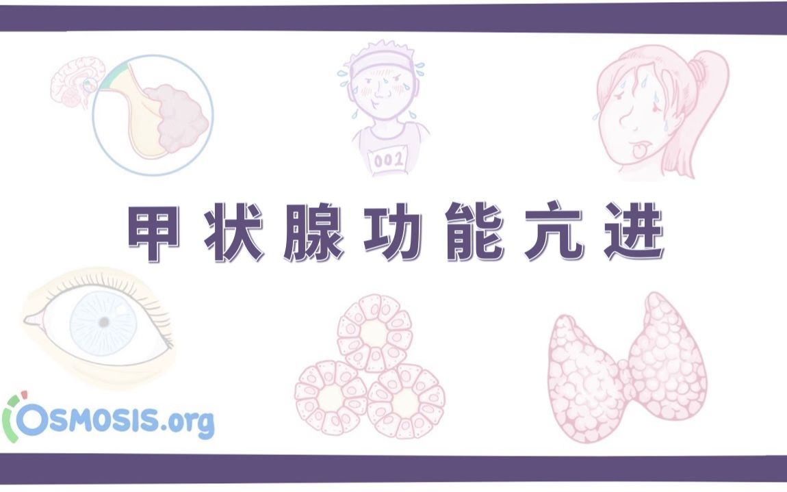 【预习】甲状腺功能亢进 Hyperthyroidism(中英字幕)哔哩哔哩bilibili