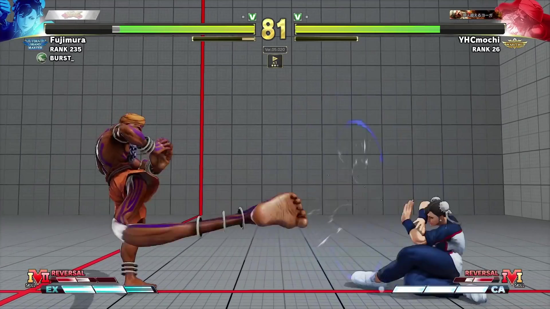 【街霸5】腹肌某啦(春丽) vs 饼爷 (长手)