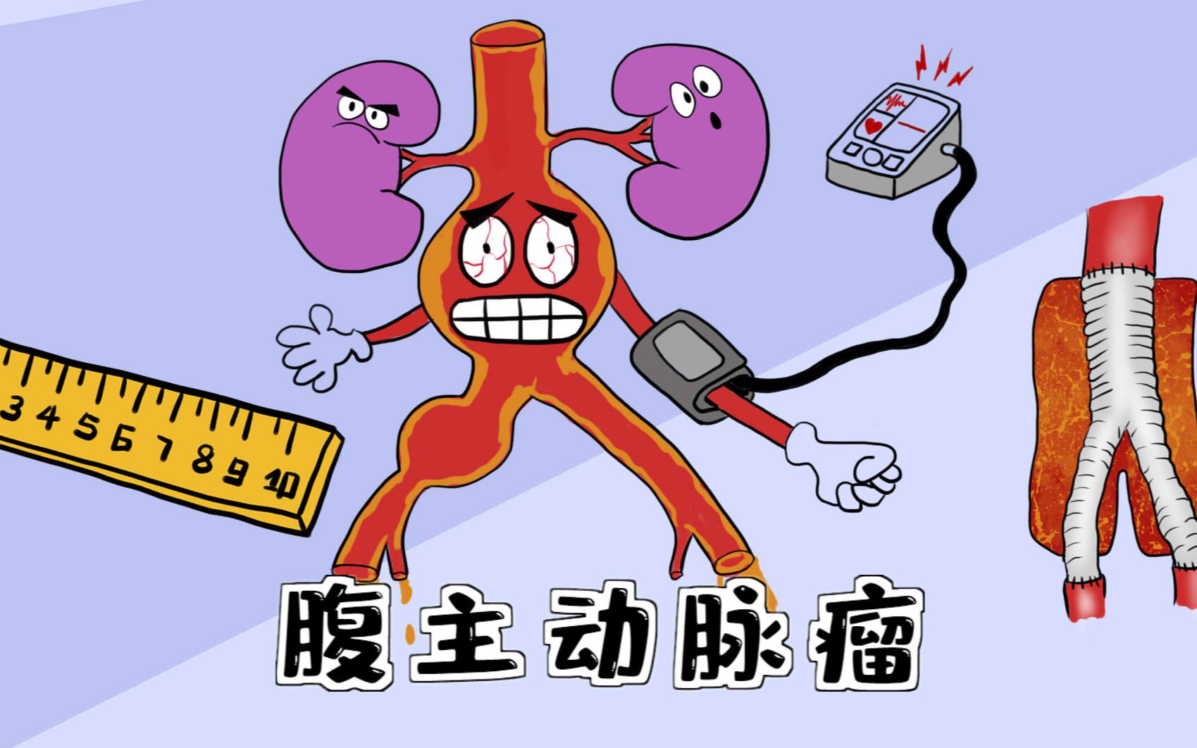 漫画| 【腹主动脉瘤】