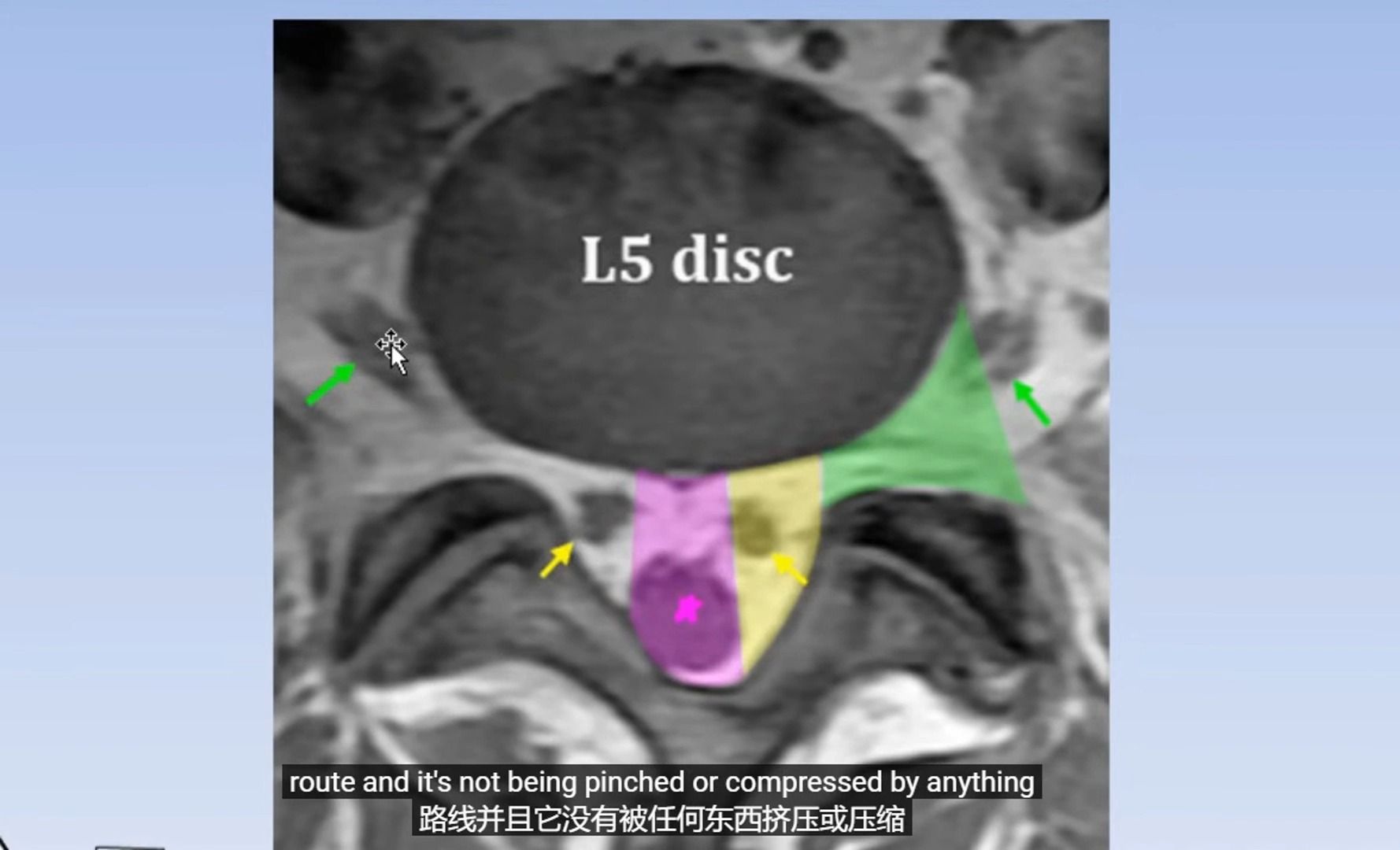 腰椎MRI阅片要点哔哩哔哩bilibili