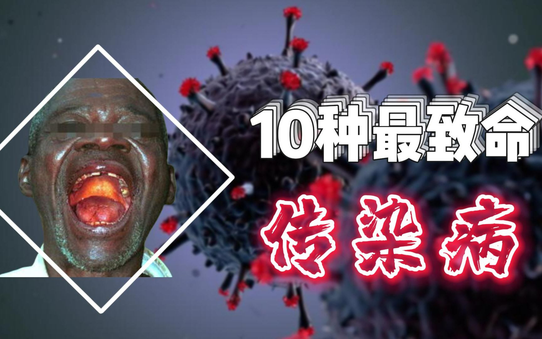 [图]致死率99%！！！最恐怖的10种流行传染病