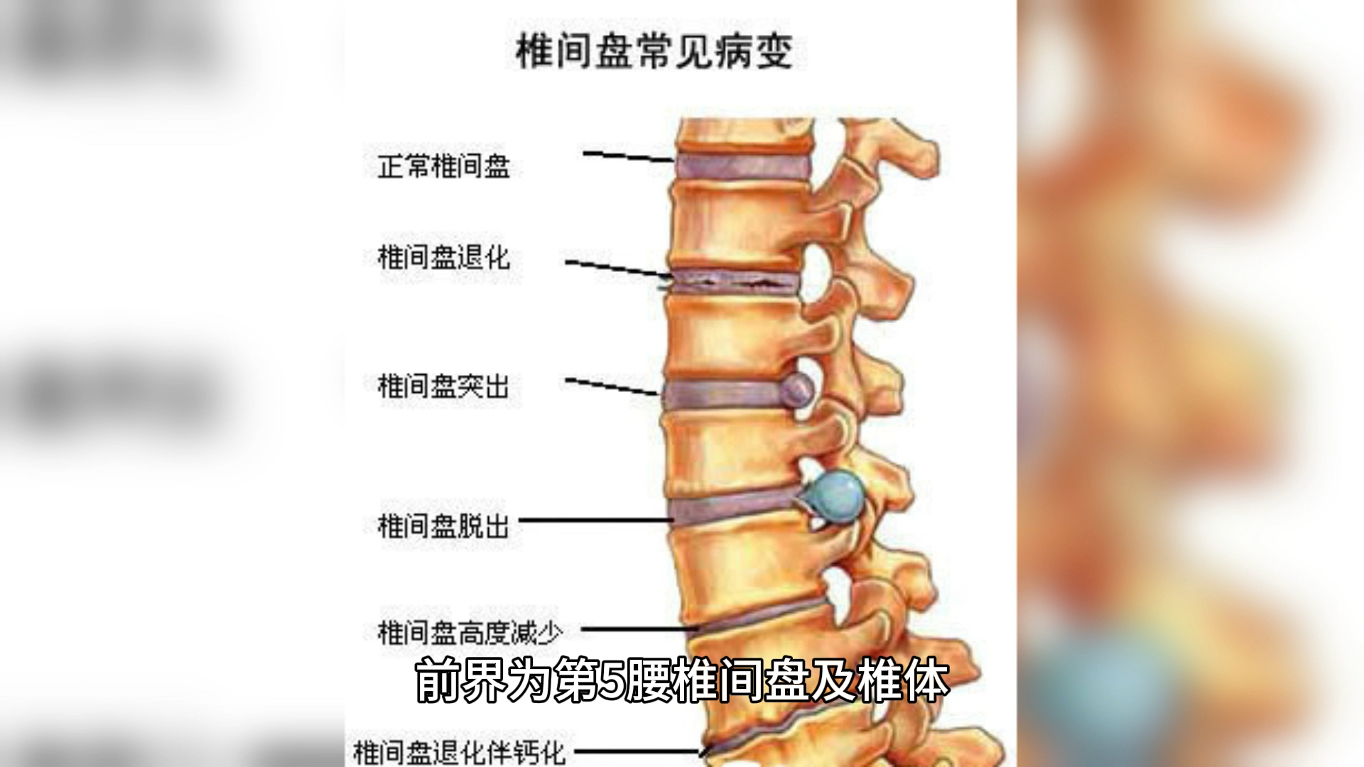 骶骨部位图图片