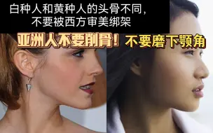 Download Video: 【不要整容】东方人和西方人天生头骨就不同！不要垫鼻子，不要磨骨，不要削下颚角！