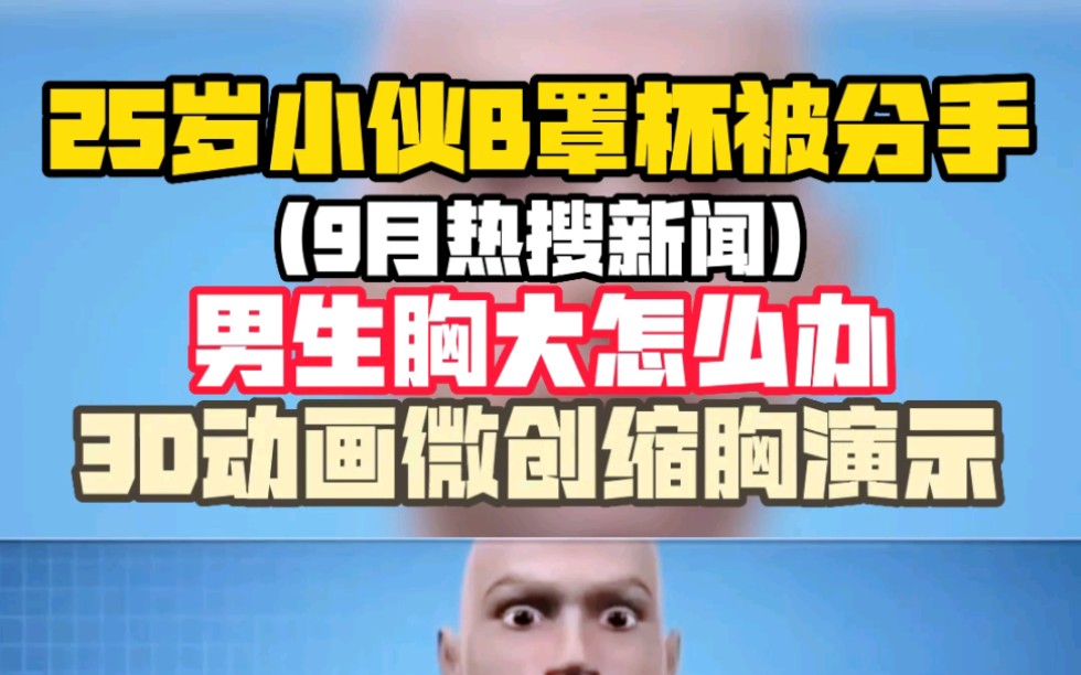 25岁小伙b罩杯被分手(9月热搜),男生胸大怎么办,3d动画演示微创缩胸