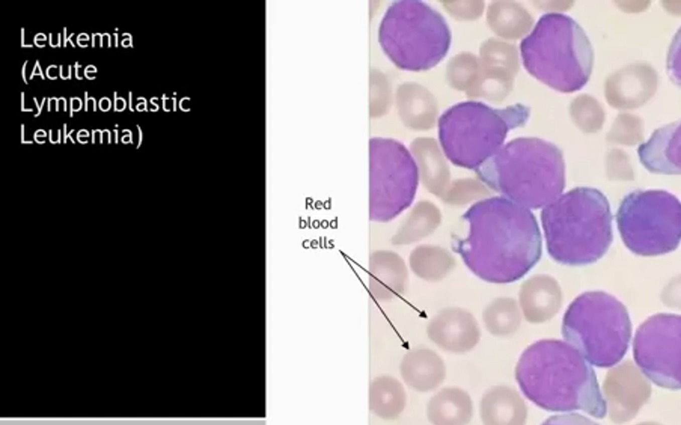 [图]1.3 Incidence and Etiology of Cancer 癌症的发病率和病因学