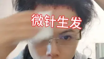 微针生发告别秃头