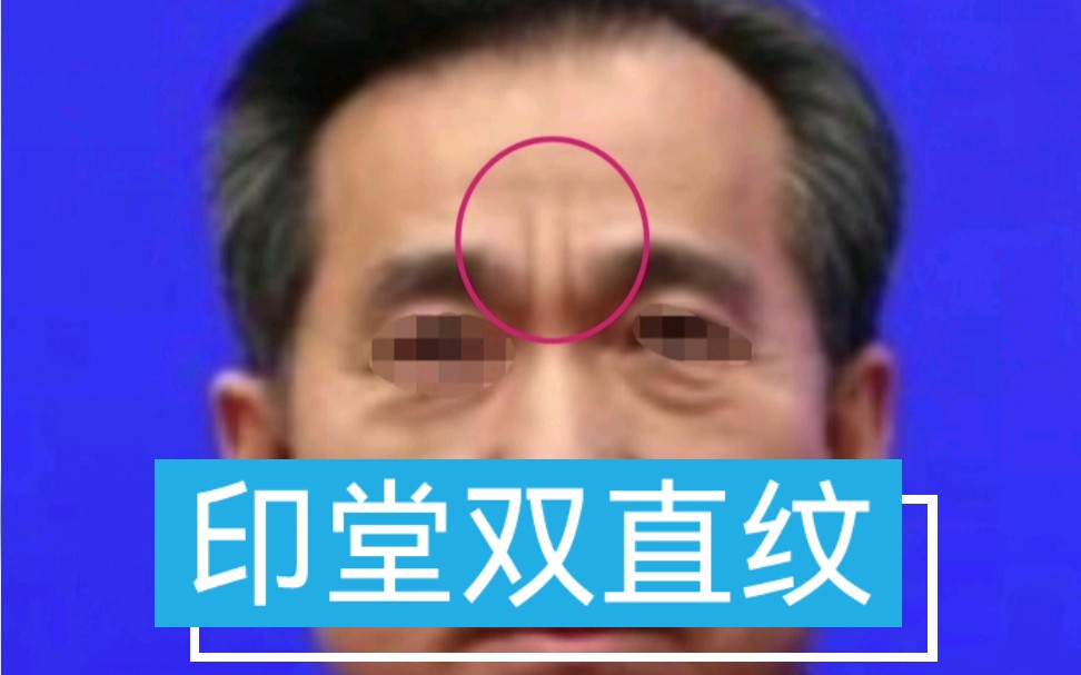 【印堂双直纹】多主意志坚强,白手起家,更适合搞一些学术研究,技术性更强的工作!哔哩哔哩bilibili