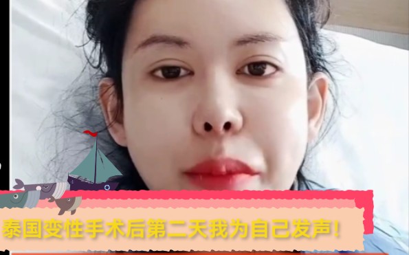 6.26泰国变性手术后第二天 我为自己发声
