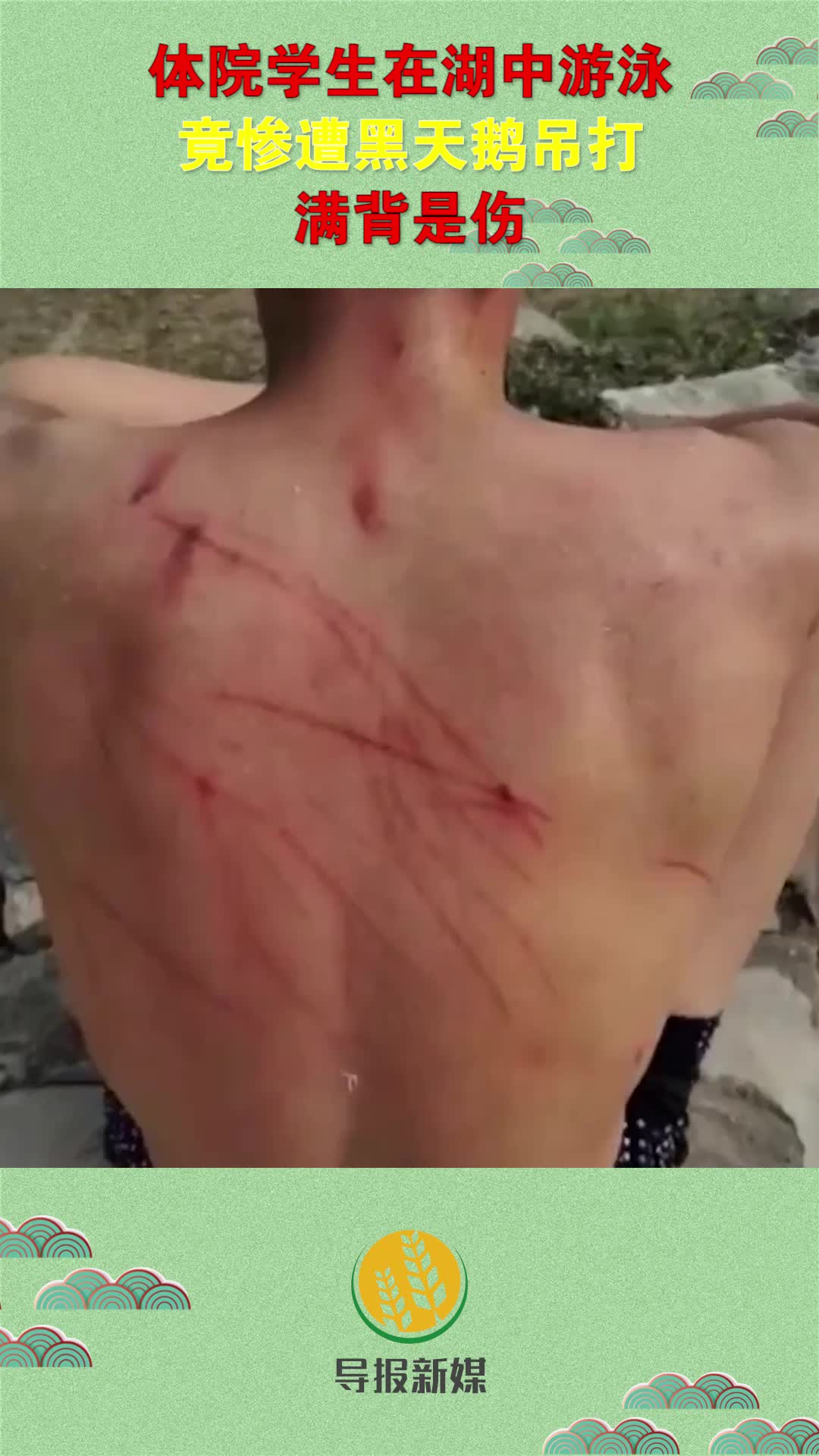 体院男学生和湖里黑天鹅"斗殴",惨遭吊打,满背长长的红色伤痕