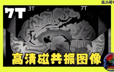 7T磁共振图像来了,比3T高清太多哔哩哔哩bilibili